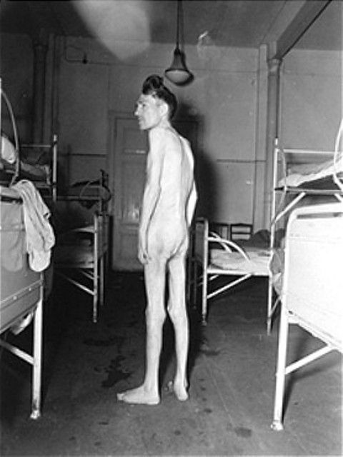 An emaciated survivor stands naked between rows of beds at the Hadamar Institute